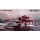 LG_65QNED7S6QA_LEDTV65InchQNED7SSeries-i3.jpg